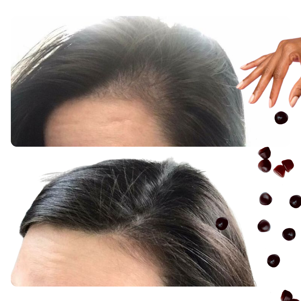 Hair Growth Daily Gummies™ WOMEN